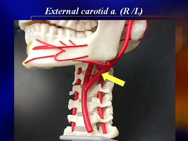 External carotid a. (R /L) 