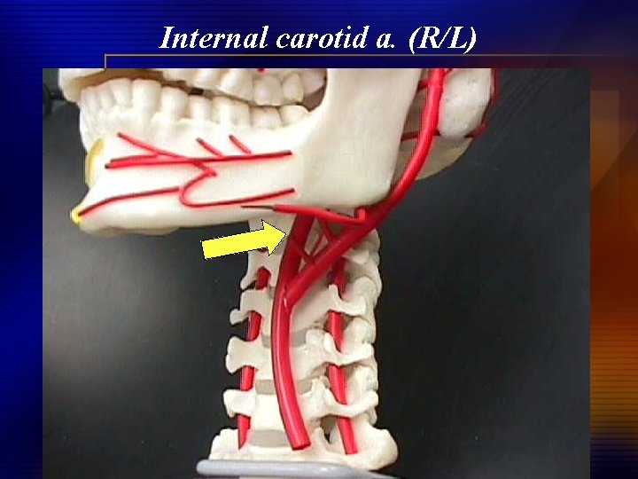 Internal carotid a. (R/L) 