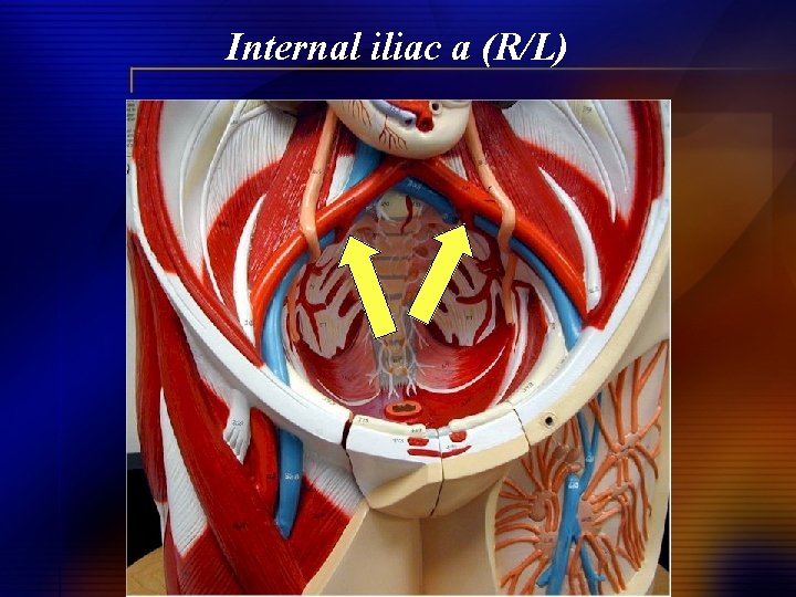 Internal iliac a (R/L) 