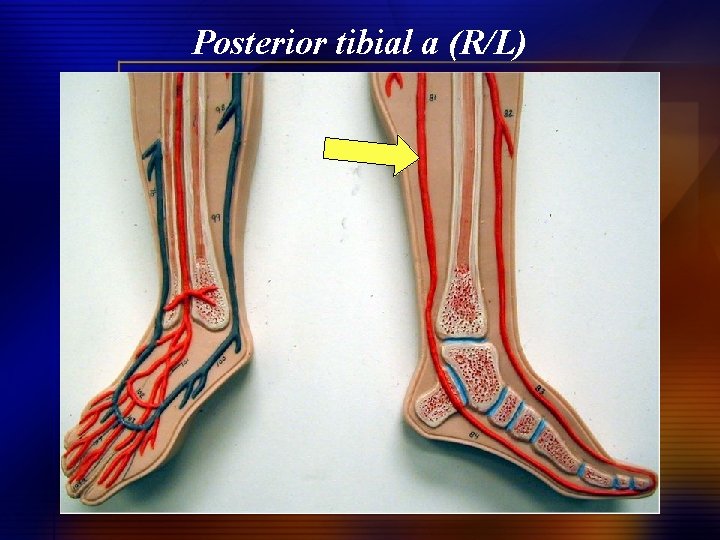 Posterior tibial a (R/L) 