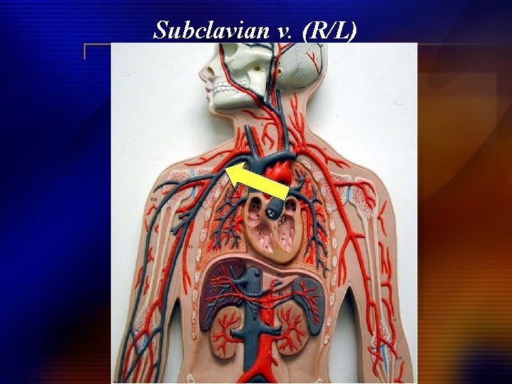 Subclavian v. (R/L) 