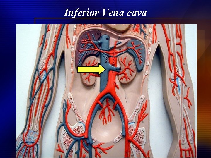 Inferior Vena cava 