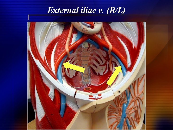 External iliac v. (R/L) 