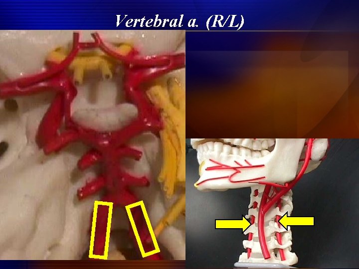 Vertebral a. (R/L) 