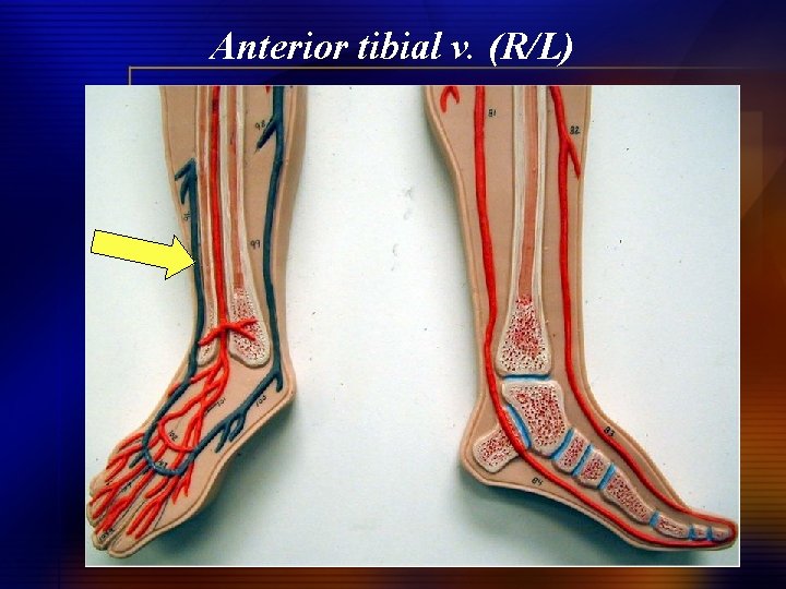 Anterior tibial v. (R/L) 