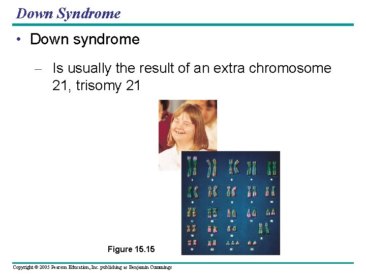 Down Syndrome • Down syndrome – Is usually the result of an extra chromosome