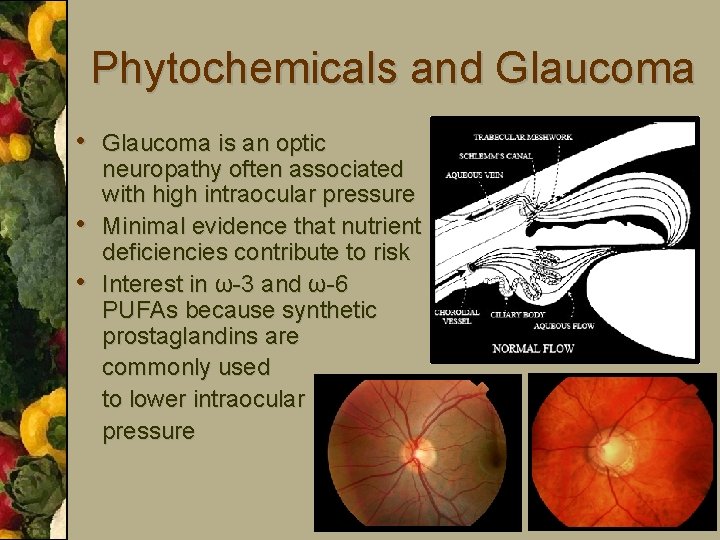Phytochemicals and Glaucoma • Glaucoma is an optic • • neuropathy often associated with
