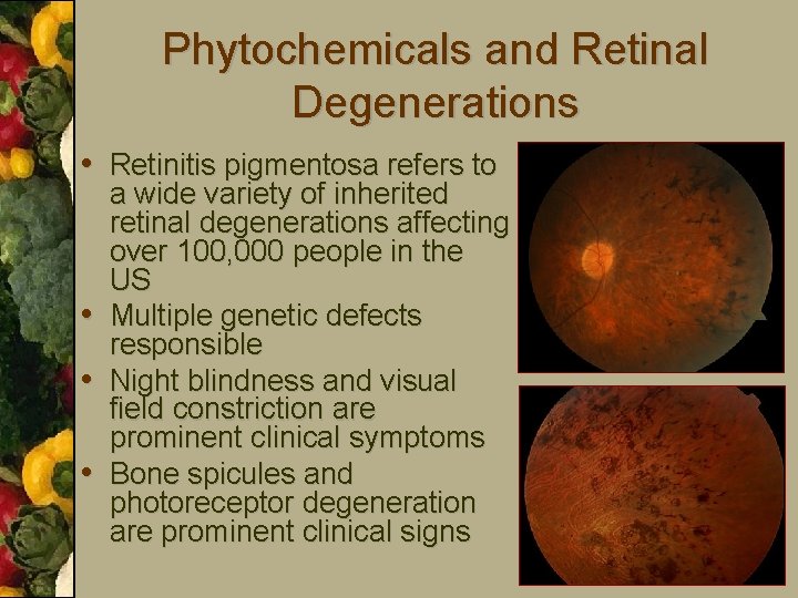 Phytochemicals and Retinal Degenerations • Retinitis pigmentosa refers to • • • a wide
