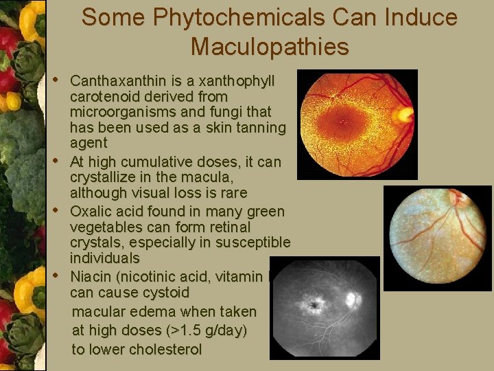 Some Phytochemicals Can Induce Maculopathies • Canthaxanthin is a xanthophyll • • • carotenoid