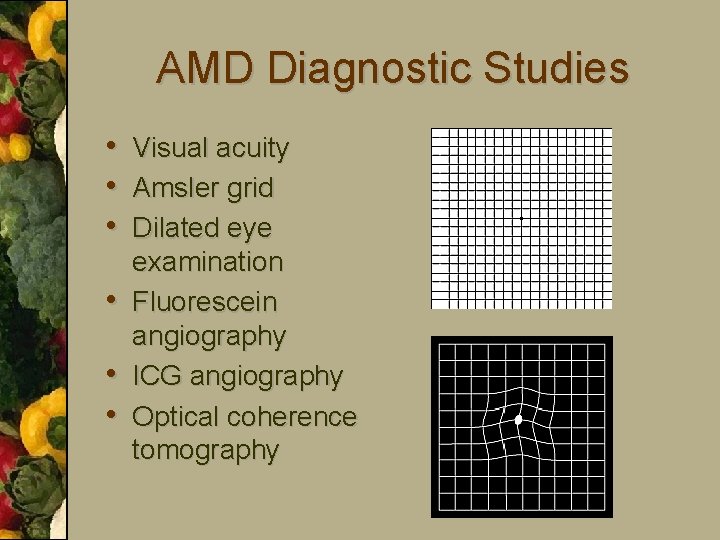 AMD Diagnostic Studies • Visual acuity • Amsler grid • Dilated eye • •