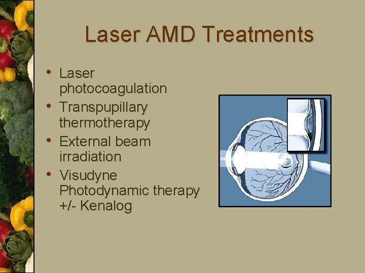 Laser AMD Treatments • Laser • • • photocoagulation Transpupillary thermotherapy External beam irradiation