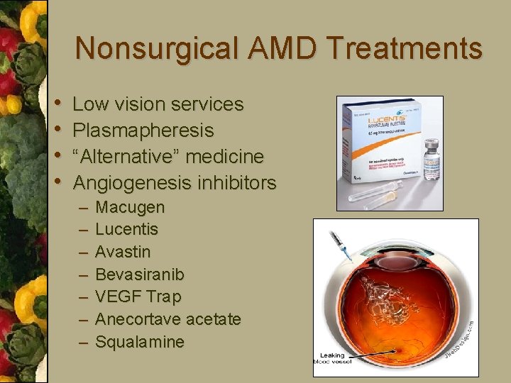 Nonsurgical AMD Treatments • • Low vision services Plasmapheresis “Alternative” medicine Angiogenesis inhibitors –