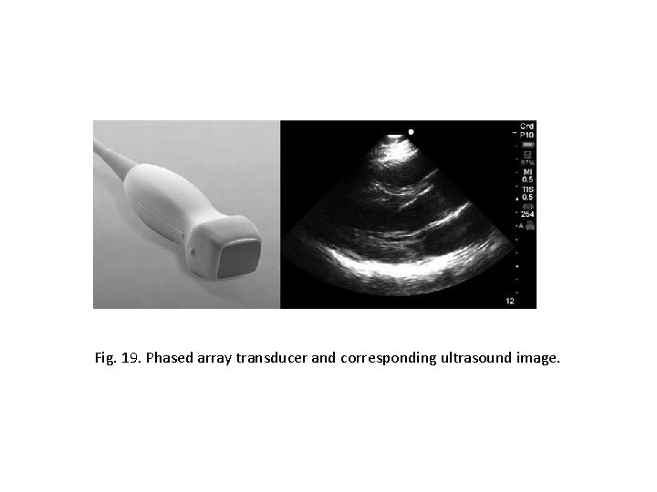 Fig. 19. Phased array transducer and corresponding ultrasound image. 