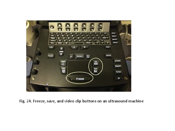 Fig. 24. Freeze, save, and video clip buttons on an ultrasound machine 