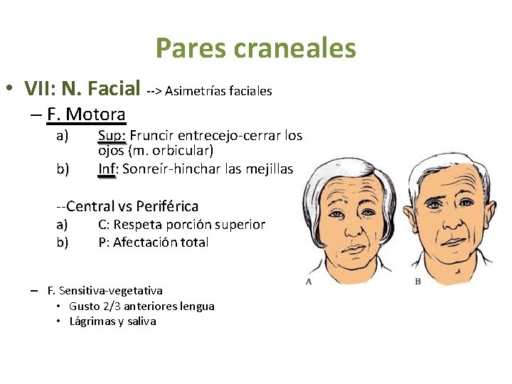 Pares craneales • VII: N. Facial --> Asimetrías faciales – F. Motora a) b)