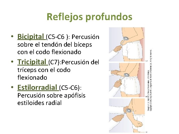 Reflejos profundos • Bicipital (C 5 -C 6 ): Percusión sobre el tendón del