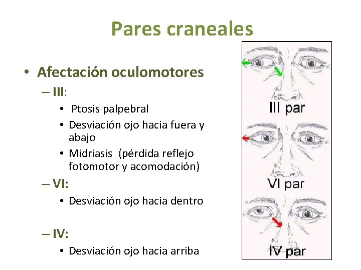 Pares craneales • Afectación oculomotores – III: • Ptosis palpebral • Desviación ojo hacia