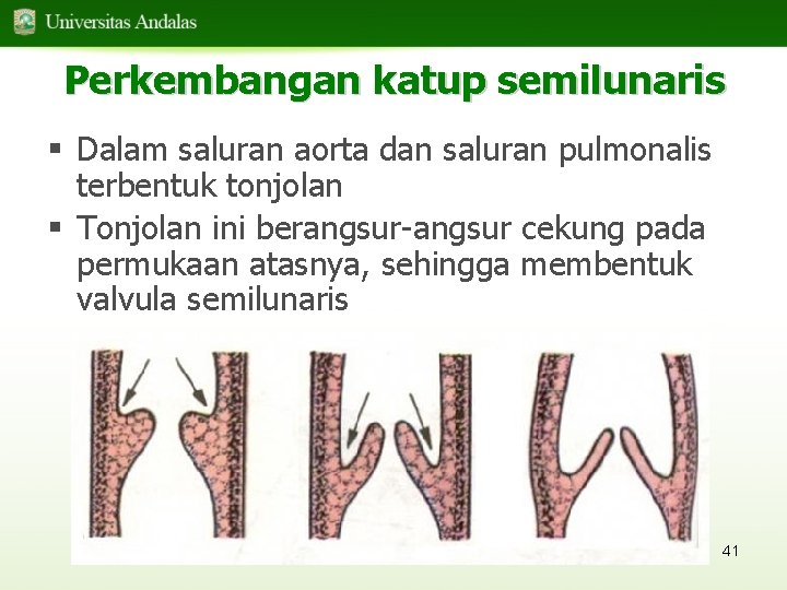 Perkembangan katup semilunaris § Dalam saluran aorta dan saluran pulmonalis terbentuk tonjolan § Tonjolan