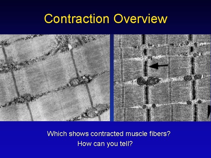 Contraction Overview Which shows contracted muscle fibers? How can you tell? 