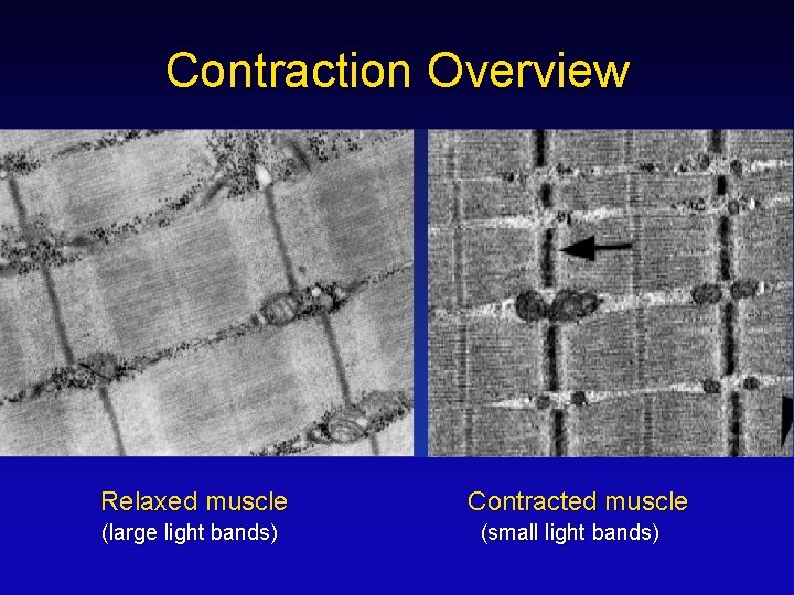 Contraction Overview Relaxed muscle (large light bands) Contracted muscle (small light bands) 