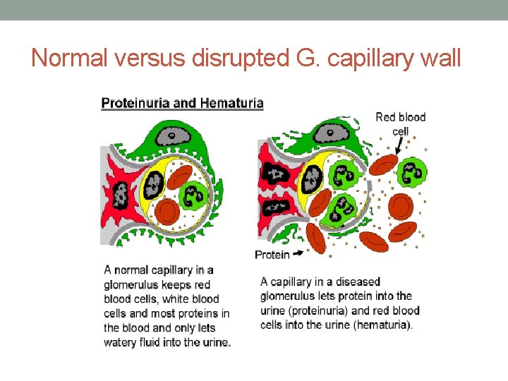 Normal versus disrupted G. capillary wall 