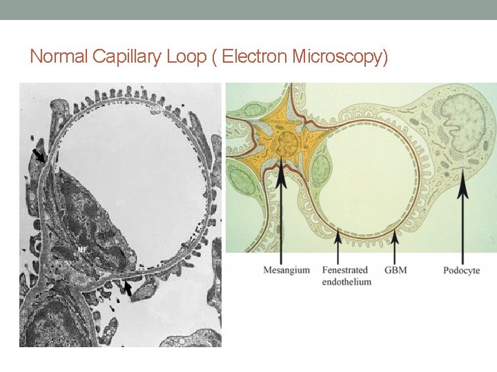 Normal Capillary Loop ( Electron Microscopy) 