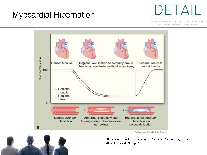 Myocardial Hibernation 18. Dilsizian and Narula Atlas of Nuclear Cardiology, 3 rd Ed. 2009;