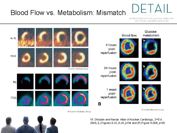 Blood Flow vs. Metabolism: Mismatch N-13 FDG 18. Dilsizian and Narula Atlas of Nuclear