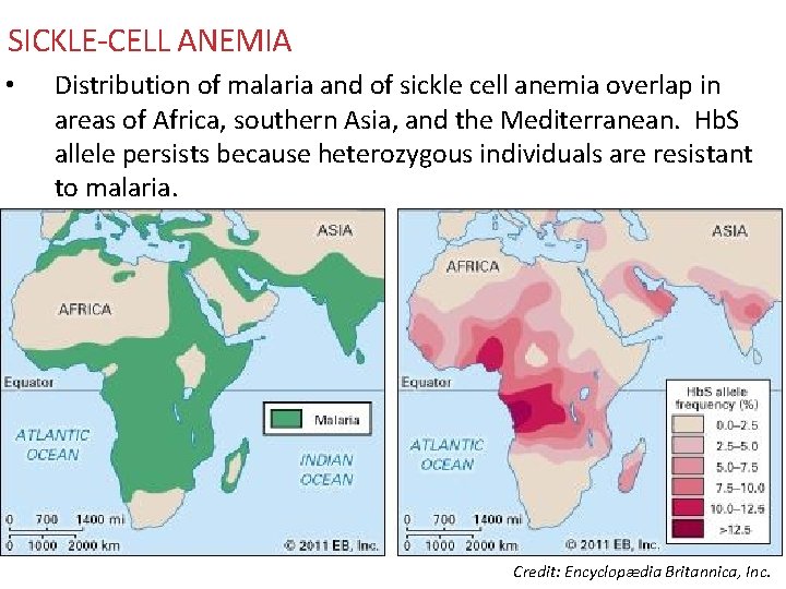 SICKLE-CELL ANEMIA • Distribution of malaria and of sickle cell anemia overlap in areas