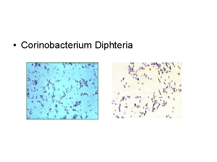  • Corinobacterium Diphteria 