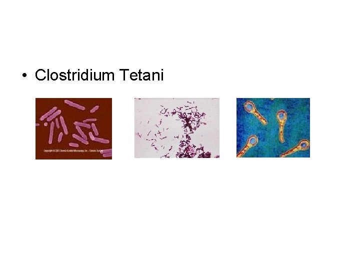  • Clostridium Tetani 