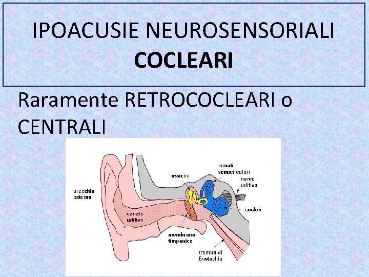 IPOACUSIE NEUROSENSORIALI COCLEARI Raramente RETROCOCLEARI o CENTRALI 