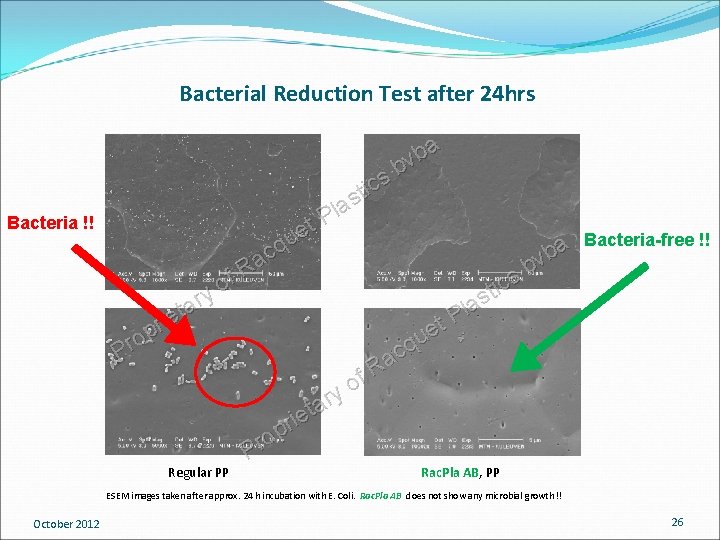 Bacterial Reduction Test after 24 hrs Bacteria !! f o y r a t