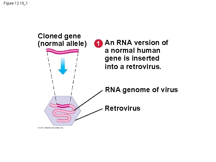 Figure 12. 10_1 Cloned gene (normal allele) 1 An RNA version of a normal