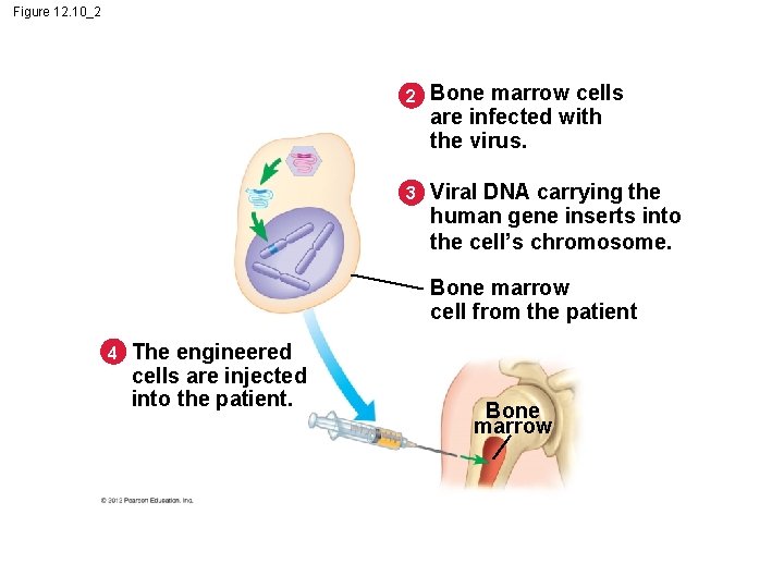 Figure 12. 10_2 2 Bone marrow cells are infected with the virus. 3 Viral