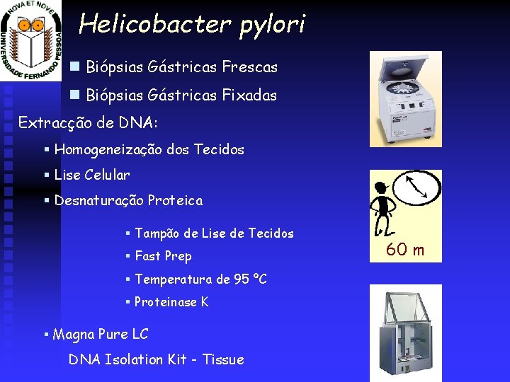 Helicobacter pylori Biópsias Gástricas Frescas Biópsias Gástricas Fixadas Extracção de DNA: § Homogeneização dos