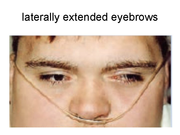 laterally extended eyebrows 