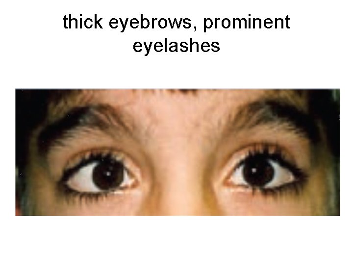 thick eyebrows, prominent eyelashes 