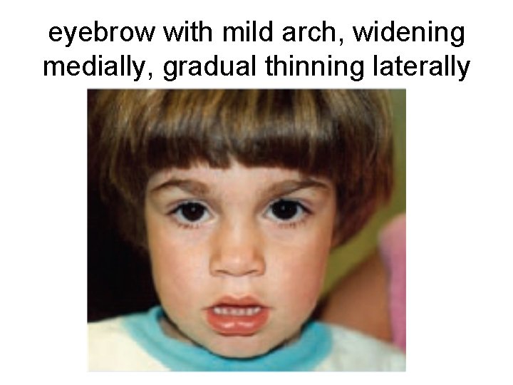 eyebrow with mild arch, widening medially, gradual thinning laterally 