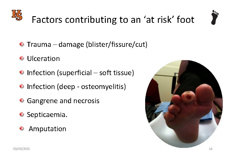 Factors contributing to an ‘at risk’ foot Trauma – damage (blister/fissure/cut) Ulceration Infection (superficial