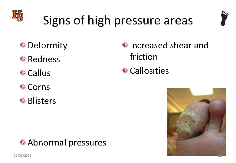 Signs of high pressure areas Deformity Redness Callus Corns Blisters Increased shear and friction