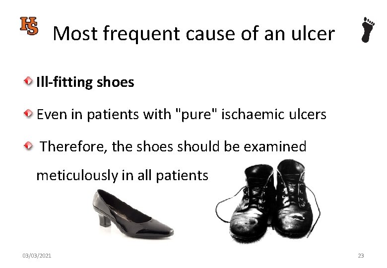 Most frequent cause of an ulcer Ill-fitting shoes Even in patients with "pure" ischaemic