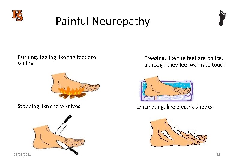 Painful Neuropathy Burning, feeling like the feet are on fire Stabbing like sharp knives