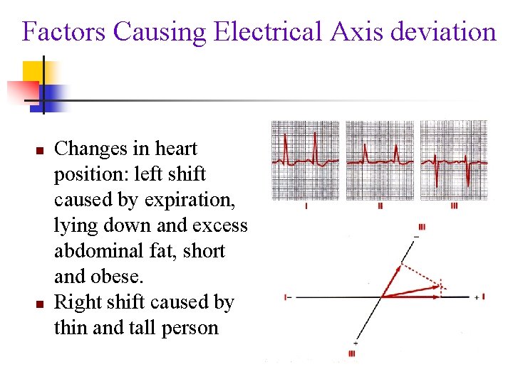 Factors Causing Electrical Axis deviation n n Changes in heart position: left shift caused