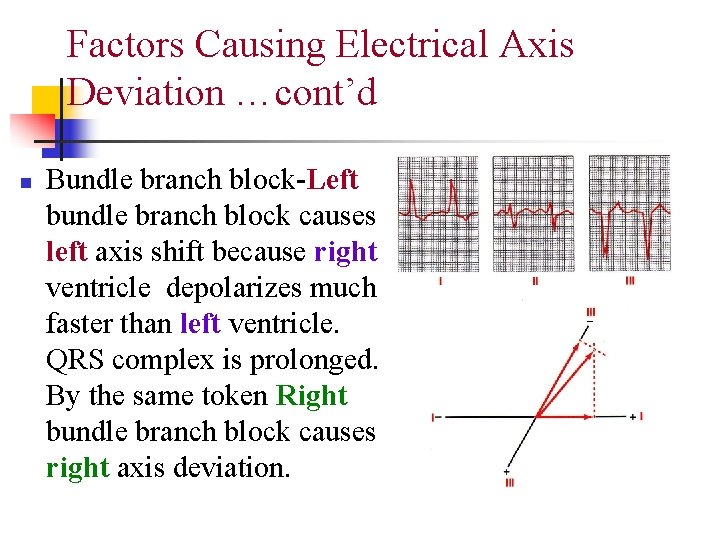 Factors Causing Electrical Axis Deviation …cont’d n Bundle branch block-Left bundle branch block causes