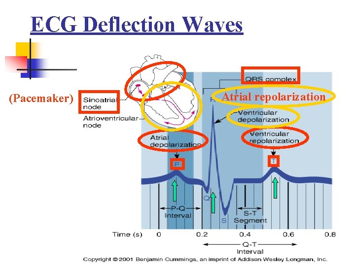 ECG Deflection Waves (Pacemaker) 24 Atrial repolarization 
