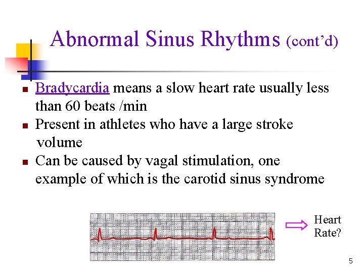 Abnormal Sinus Rhythms (cont’d) n n n Bradycardia means a slow heart rate usually