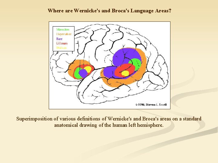 Where are Wernicke's and Broca's Language Areas? Superimposition of various definitions of Wernicke's and