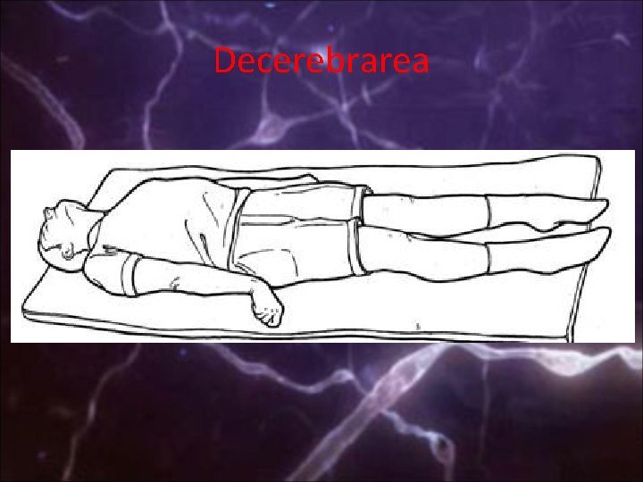 Decerebrarea 