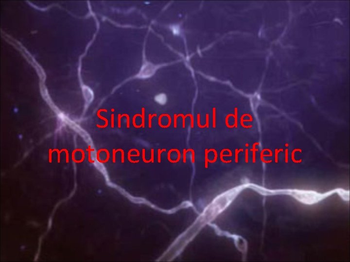 Sindromul de motoneuron periferic 